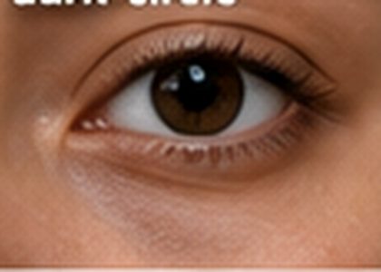 eye care 020