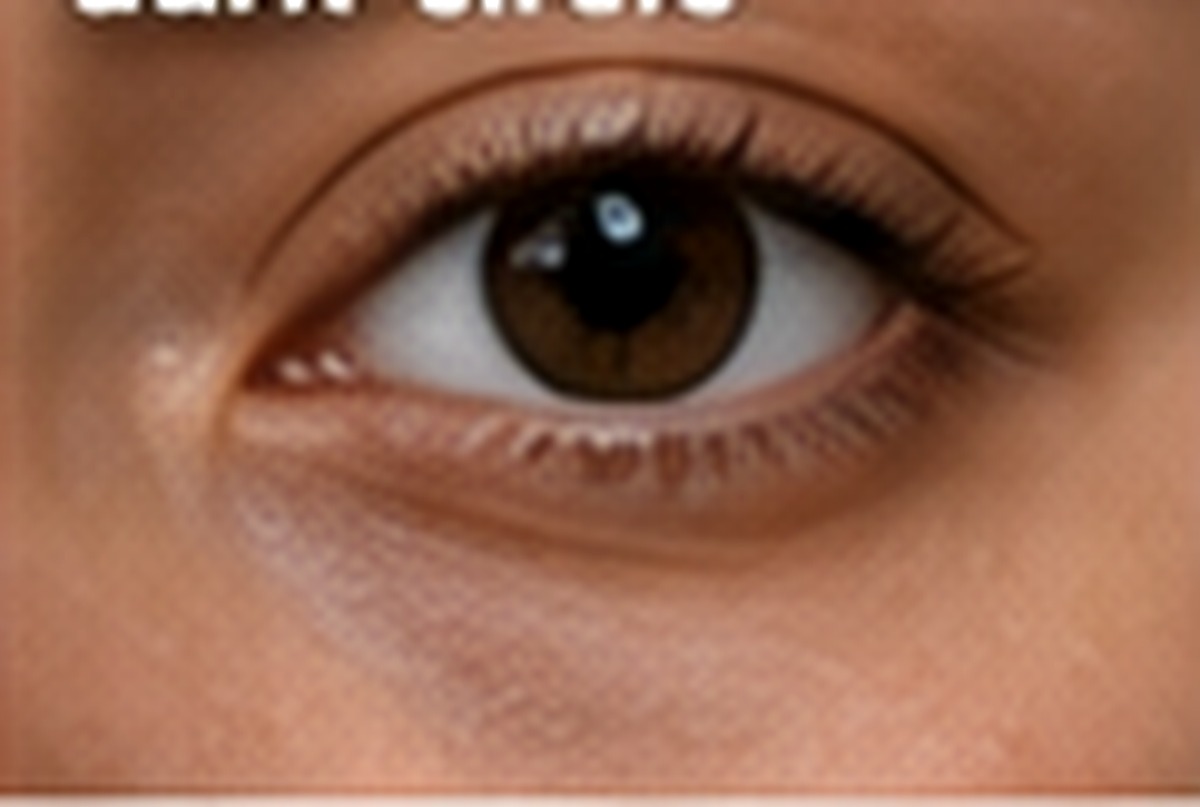 eye care 020