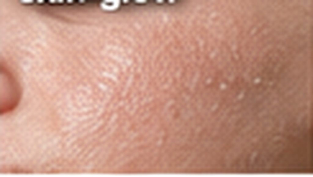 skin glow 066